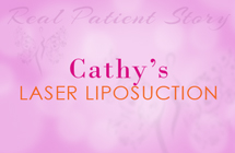 cathy-laser-lipo