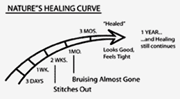 post cosmetic surgery healing curve post cosmetic surgery healing curve