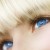 Eye Bag Surgery (Lower Blepharoplasty)