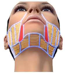 Ultherapy
