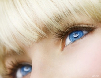 Eye Bag Surgery