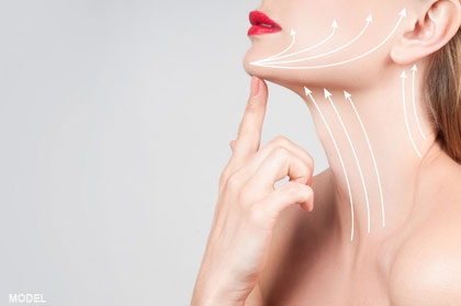 Ultherapy® SMAS Lift